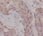 Anti-Hsc70 HSPA8 Rabbit Monoclonal Antibody